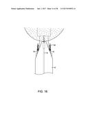 METHODS AND DEVICES FOR MANIPULATING AND FASTENING TISSUE diagram and image