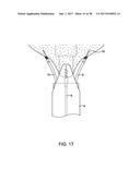 METHODS AND DEVICES FOR MANIPULATING AND FASTENING TISSUE diagram and image