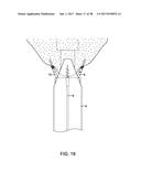 METHODS AND DEVICES FOR MANIPULATING AND FASTENING TISSUE diagram and image