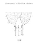 METHODS AND DEVICES FOR MANIPULATING AND FASTENING TISSUE diagram and image