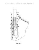 METHODS AND DEVICES FOR MANIPULATING AND FASTENING TISSUE diagram and image