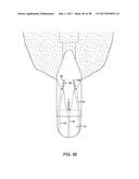 METHODS AND DEVICES FOR MANIPULATING AND FASTENING TISSUE diagram and image