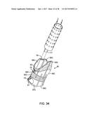 METHODS AND DEVICES FOR MANIPULATING AND FASTENING TISSUE diagram and image