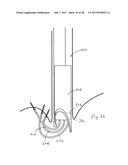 METHODS AND DEVICES FOR MANIPULATING AND FASTENING TISSUE diagram and image