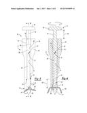 SUTURE ANCHOR AND RELATED METHOD diagram and image