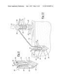 SUTURE ANCHOR AND RELATED METHOD diagram and image