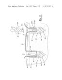 SUTURE ANCHOR AND RELATED METHOD diagram and image