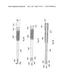 IMPLANT PLACEMENT SYSTEMS, DEVICES AND METHODS diagram and image