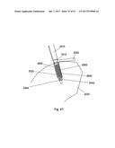 IMPLANT PLACEMENT SYSTEMS, DEVICES AND METHODS diagram and image