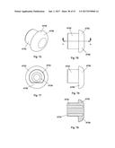 IMPLANT PLACEMENT SYSTEMS, DEVICES AND METHODS diagram and image