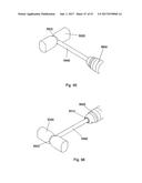 IMPLANT PLACEMENT SYSTEMS, DEVICES AND METHODS diagram and image