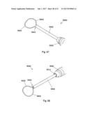 IMPLANT PLACEMENT SYSTEMS, DEVICES AND METHODS diagram and image