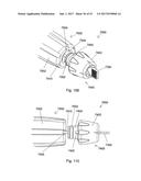IMPLANT PLACEMENT SYSTEMS, DEVICES AND METHODS diagram and image