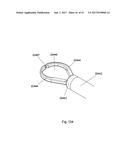 IMPLANT PLACEMENT SYSTEMS, DEVICES AND METHODS diagram and image