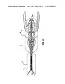 Endoscopic Stitching Devices diagram and image