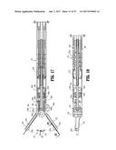 Endoscopic Stitching Devices diagram and image