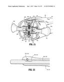 Endoscopic Stitching Devices diagram and image