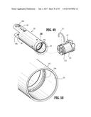 Endoscopic Stitching Devices diagram and image