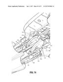 Endoscopic Stitching Devices diagram and image