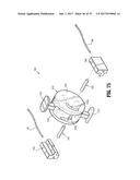 Endoscopic Stitching Devices diagram and image