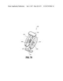 Endoscopic Stitching Devices diagram and image