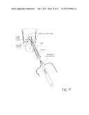 SUTURE SLEEVE PATCH AND METHODS OF DELIVERY WITHIN AN EXISTING     ARTHROSCOPIC WORKFLOW diagram and image