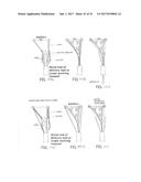 SUTURE SLEEVE PATCH AND METHODS OF DELIVERY WITHIN AN EXISTING     ARTHROSCOPIC WORKFLOW diagram and image