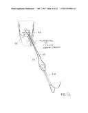 SUTURE SLEEVE PATCH AND METHODS OF DELIVERY WITHIN AN EXISTING     ARTHROSCOPIC WORKFLOW diagram and image