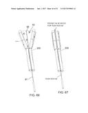 SUTURE SLEEVE PATCH AND METHODS OF DELIVERY WITHIN AN EXISTING     ARTHROSCOPIC WORKFLOW diagram and image