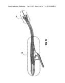 Ratcheting Mechanism for Surgical Stapling Device diagram and image