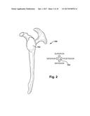 SYSTEM AND METHOD FOR ASSOCIATION OF A GUIDING AID WITH A PATIENT TISSUE diagram and image