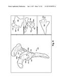 SYSTEM AND METHOD FOR ASSOCIATION OF A GUIDING AID WITH A PATIENT TISSUE diagram and image