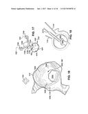 SYSTEM AND METHOD FOR ASSOCIATION OF A GUIDING AID WITH A PATIENT TISSUE diagram and image