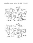 SYSTEM AND METHOD FOR ASSOCIATION OF A GUIDING AID WITH A PATIENT TISSUE diagram and image