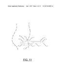 Prosthetic Artificial Insemination Device diagram and image