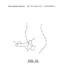 Prosthetic Artificial Insemination Device diagram and image