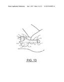 Prosthetic Artificial Insemination Device diagram and image