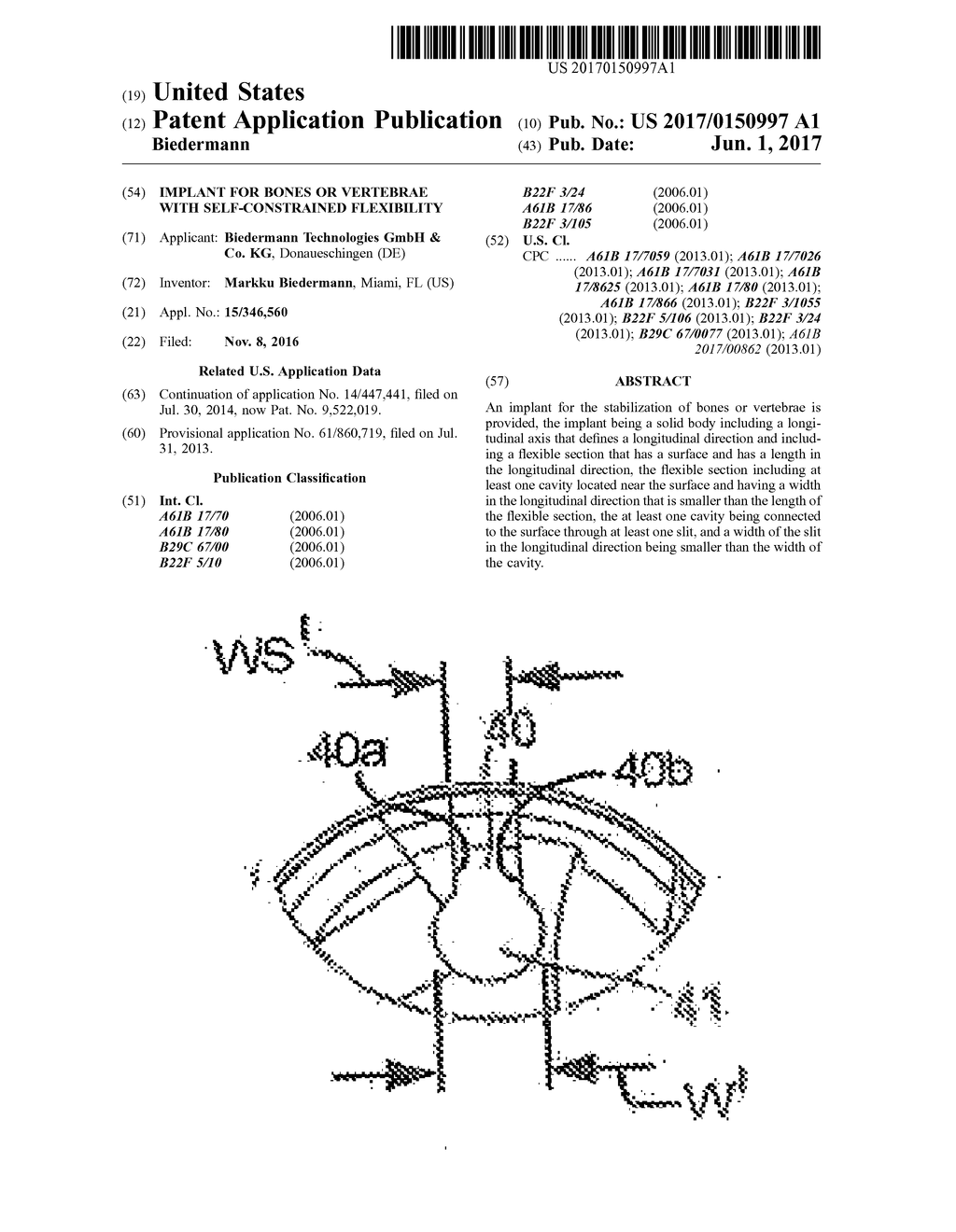 IMPLANT FOR BONES OR VERTEBRAE WITH SELF-CONSTRAINED FLEXIBILITY - diagram, schematic, and image 01