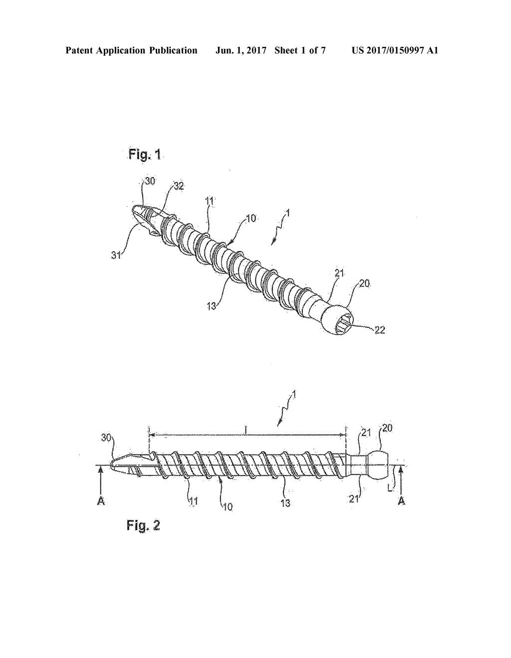 IMPLANT FOR BONES OR VERTEBRAE WITH SELF-CONSTRAINED FLEXIBILITY - diagram, schematic, and image 02