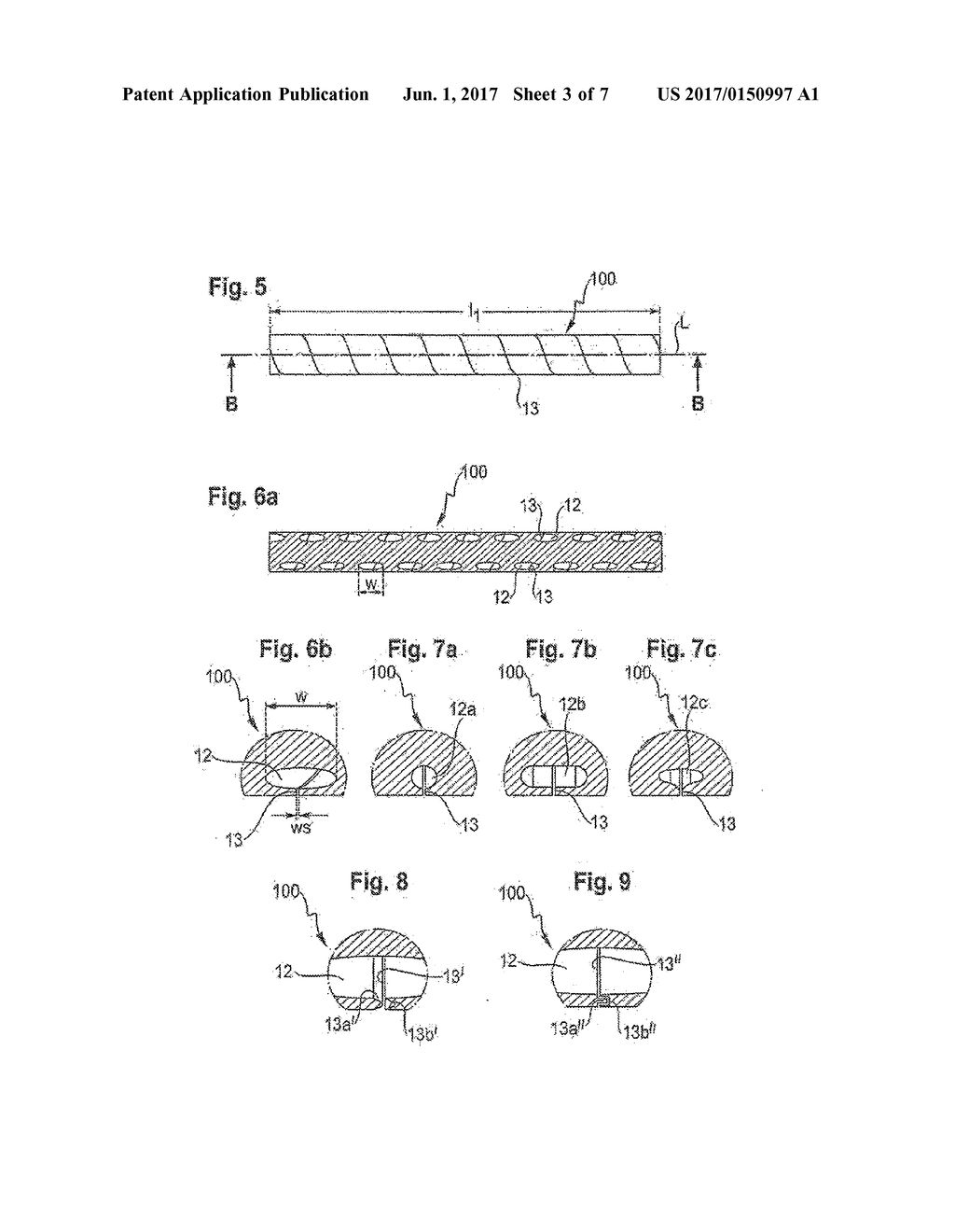 IMPLANT FOR BONES OR VERTEBRAE WITH SELF-CONSTRAINED FLEXIBILITY - diagram, schematic, and image 04