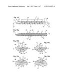 IMPLANT FOR BONES OR VERTEBRAE WITH SELF-CONSTRAINED FLEXIBILITY diagram and image