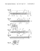 IMPLANT FOR BONES OR VERTEBRAE WITH SELF-CONSTRAINED FLEXIBILITY diagram and image