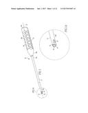 Anchor Delivery System diagram and image