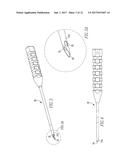 Anchor Delivery System diagram and image