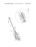 Anchor Delivery System diagram and image