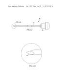 Anchor Delivery System diagram and image