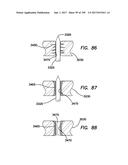 ELECTROSURGICAL SYSTEM diagram and image