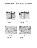 SELECTIVE FAT REMOVAL USING PHOTOTHERMAL HEATING diagram and image