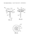 Method And Apparatus For Surgical Navigation diagram and image