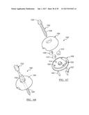 Method And Apparatus For Surgical Navigation diagram and image